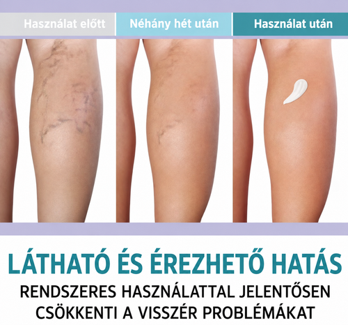LIEVA & CO. Krém (visszerekre)